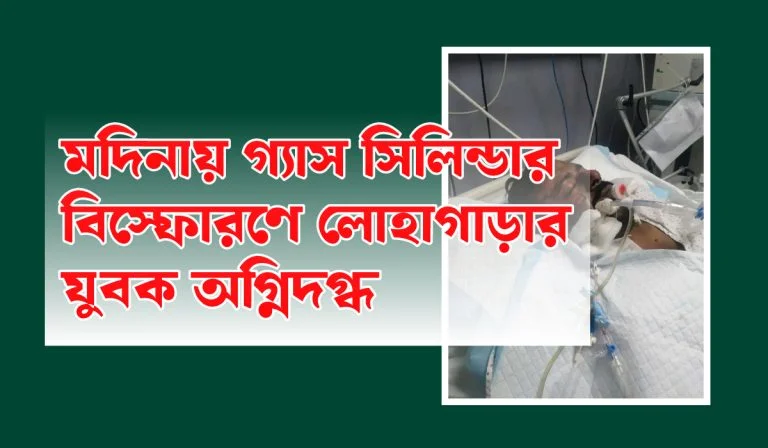 মদিনায় গ্যাস সিলিন্ডার বিস্ফোরণে লোহাগাড়ার যুবক অগ্নিদগ্ধ 